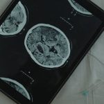 The Neuroscience of Judicial Reasoning and Decision-Making